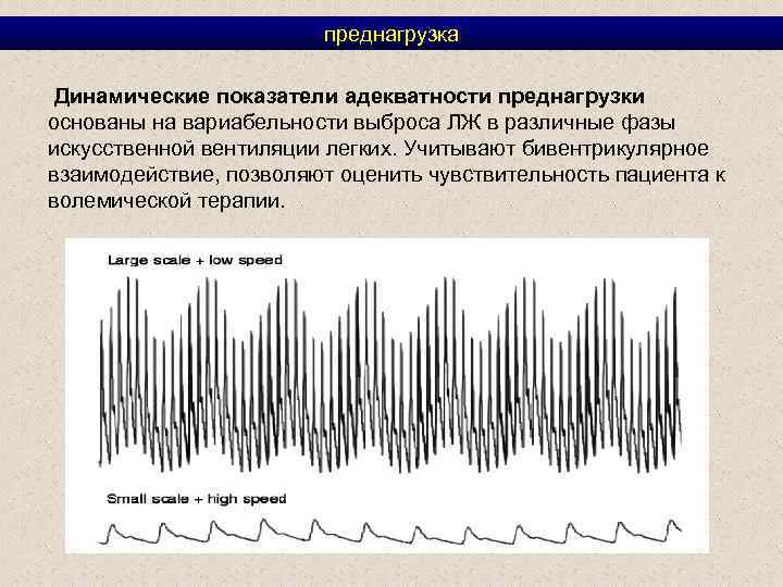 преднагрузка Динамические показатели адекватности преднагрузки основаны на вариабельности выброса ЛЖ в различные фазы искусственной