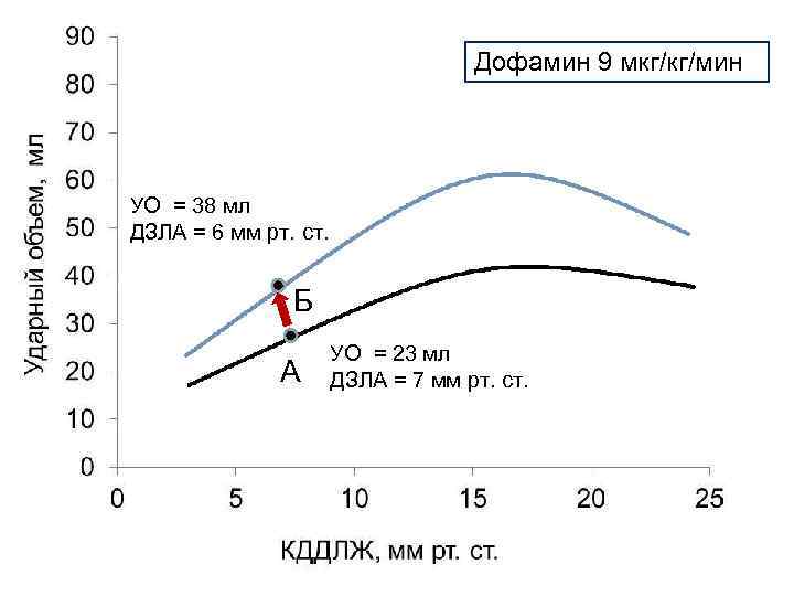 Дофамин 9 мкг/кг/мин УО = 38 мл ДЗЛА = 6 мм рт. ст. Б