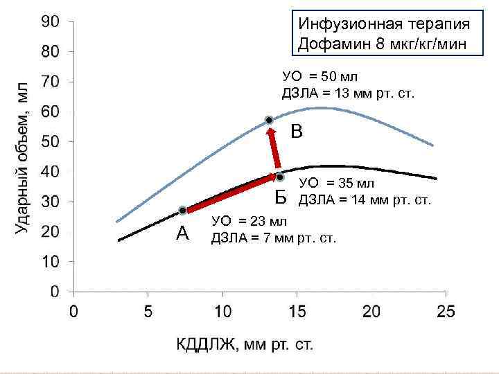 Инфузионная терапия Дофамин 8 мкг/кг/мин УО = 50 мл ДЗЛА = 13 мм рт.