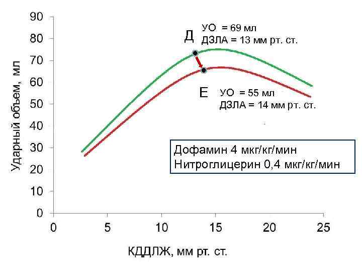 Д УО = 69 мл ДЗЛА = 13 мм рт. ст. Е УО =