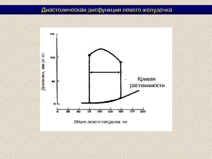  Диастолическая дисфункция левого желудочка Кривая растяжимости 