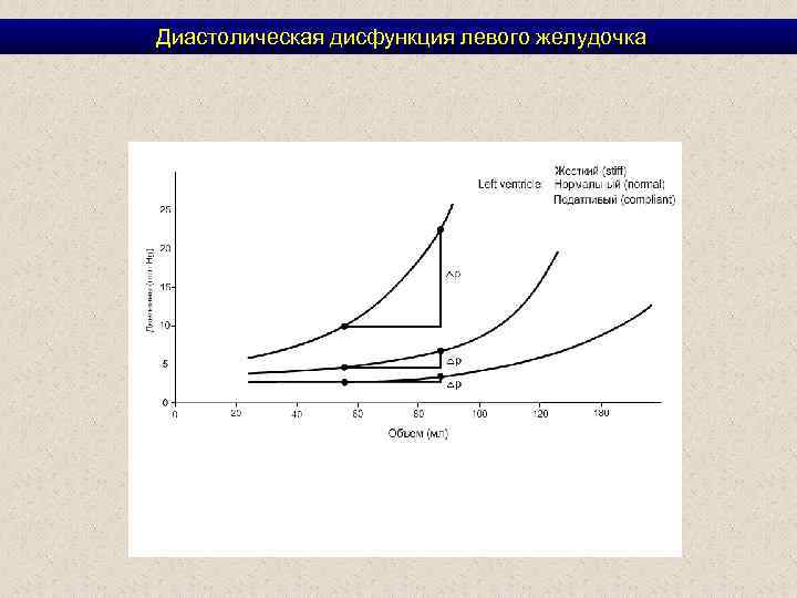  Диастолическая дисфункция левого желудочка 