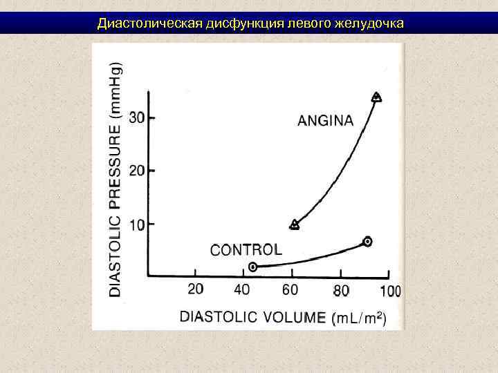  Диастолическая дисфункция левого желудочка 