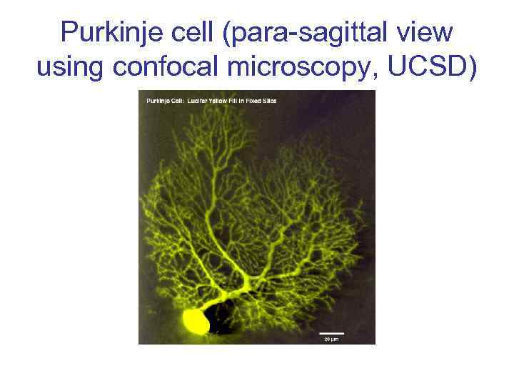 Purkinje cell (para-sagittal view using confocal microscopy, UCSD) 