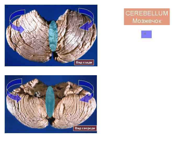 CEREBELLUM Мозжечок Vermis Червь Вид сзади Вид спереди Hemispheres Полушария 