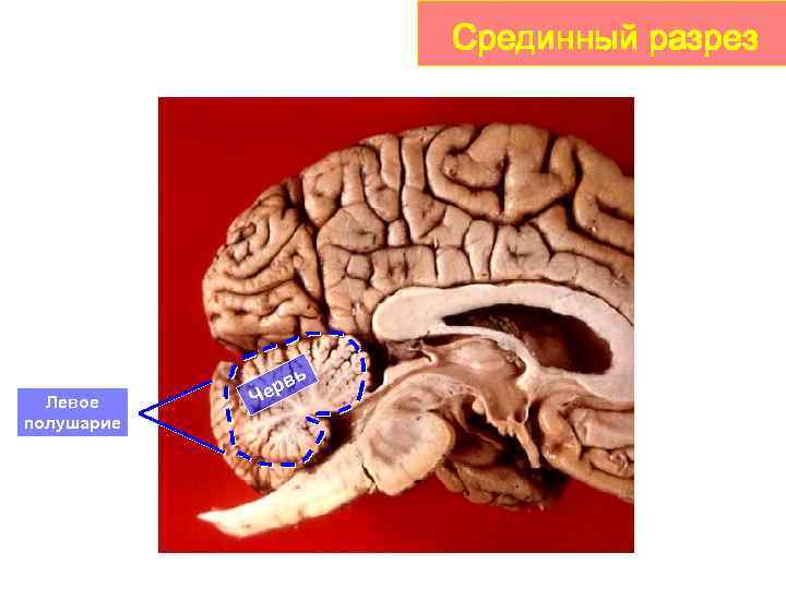 Срединный разрез ь Левое полушарие в ер Ч 