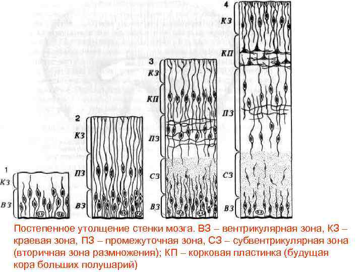 Постепенное утолщение стенки мозга. ВЗ – вентрикулярная зона, КЗ – краевая зона, ПЗ –