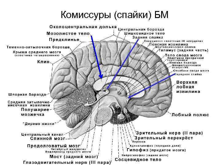 Комиссуры (спайки) БМ 