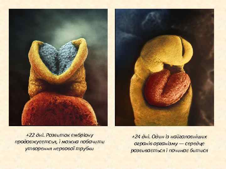 +22 дні. Розвиток ембріону продовжуєетсья, і можна побачити утворення нервової трубки +24 дні. Один