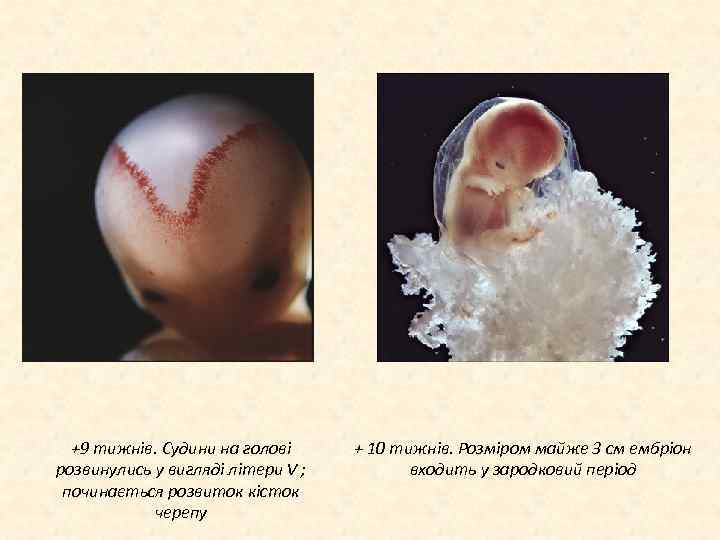 +9 тижнів. Судини на голові розвинулись у вигляді літери V ; починається розвиток кісток