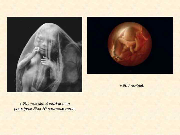 + 36 тижнів. + 20 тижнів. Зародок вже розміром біля 20 сантиметрів. 