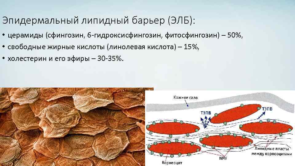 Эпидермальный липидный барьер (ЭЛБ): • церамиды (сфингозин, 6 -гидроксисфингозин, фитосфингозин) – 50%, • свободные