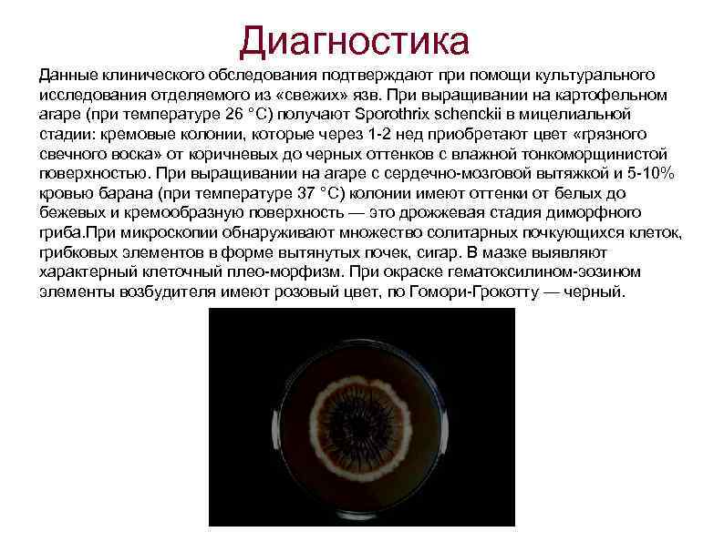 Диагностика Данные клинического обследования подтверждают при помощи культурального исследования отделяемого из «свежих» язв. При