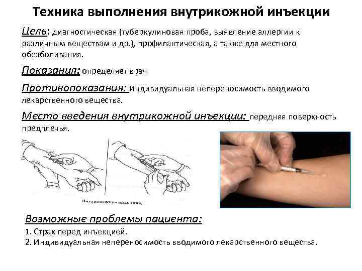 Техника выполнения внутрикожной инъекции Цель: диагностическая (туберкулиновая проба, выявление аллергии к различным веществам и