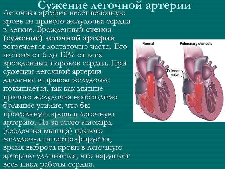 Презентация по педиатрии