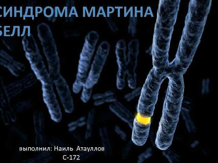 СИНДРОМА МАРТИНА БЕЛЛ выполнил: Наиль Атауллов С-172 