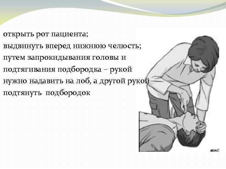 открыть рот пациента; выдвинуть вперед нижнюю челюсть; путем запрокидывания головы и подтягивания подбородка –