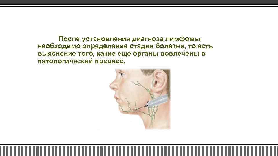 После установления диагноза лимфомы необходимо определение стадии болезни, то есть выяснение того, какие еще