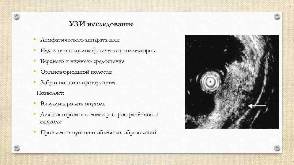 УЗИ исследование • • • Лимфатического аппарата шеи Надключичных лимфатических коллекторов Верхнего и нижнего