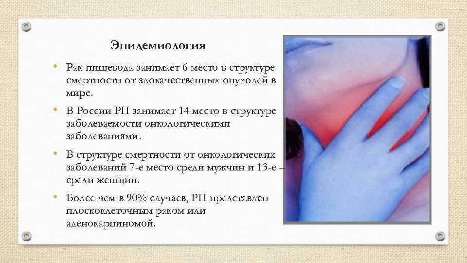 Эпидемиология • Рак пищевода занимает 6 место в структуре смертности от злокачественных опухолей в