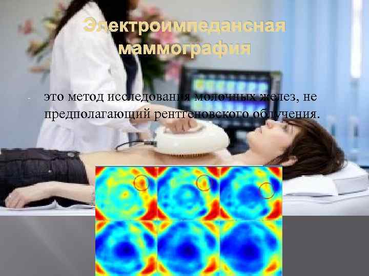 Электроимпедансная маммография - это метод исследования молочных желез, не предполагающий рентгеновского облучения. 