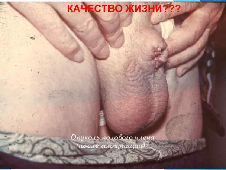 КАЧЕСТВО ЖИЗНИ? ? ? 