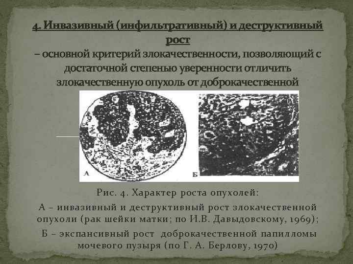 Инфильтративный неспецифический рак молочной железы