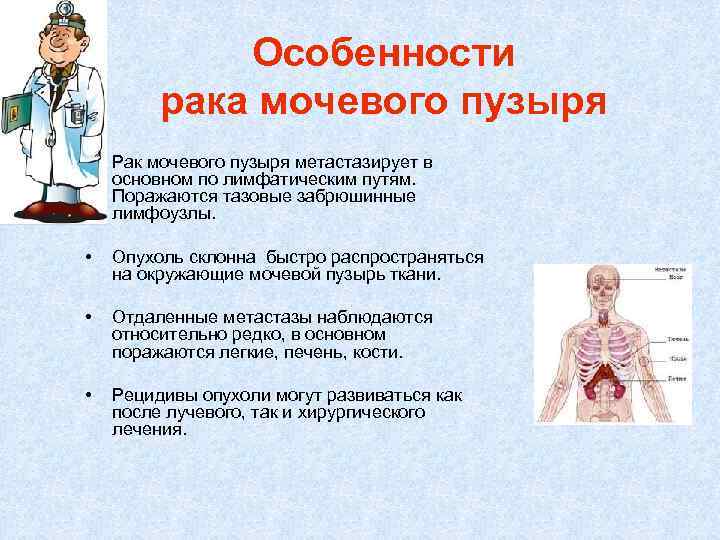 Особенности рака мочевого пузыря • Рак мочевого пузыря метастазирует в основном по лимфатическим путям.