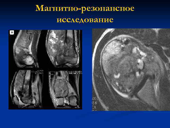 Магнитно-резонансное исследование 