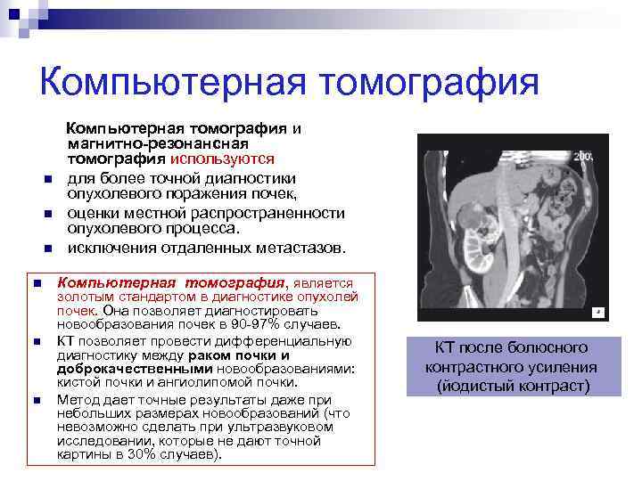 Компьютерная томография n n n Компьютерная томография и магнитно-резонансная томография используются для более точной