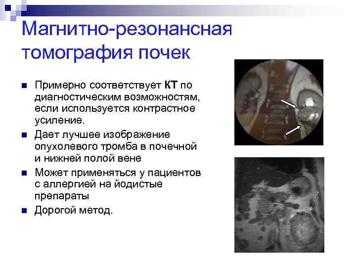 Магнитно-резонансная томография почек n n Примерно соответствует КТ по диагностическим возможностям, если используется контрастное