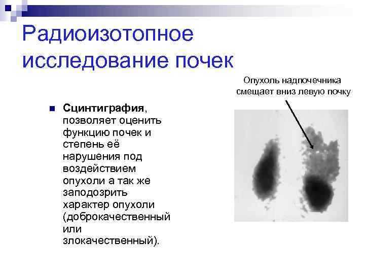 Радиоизотопные методы исследования в урологии презентация