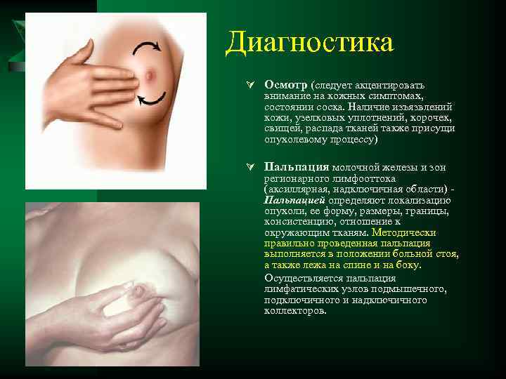 Диагностика Ú Осмотр (следует акцентировать внимание на кожных симптомах, состоянии соска. Наличие изъязвлений кожи,