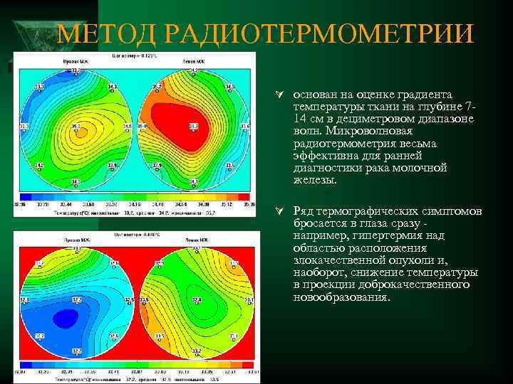 МЕТОД РАДИОТЕРМОМЕТРИИ Ú основан на оценке градиента температуры ткани на глубине 7 14 см