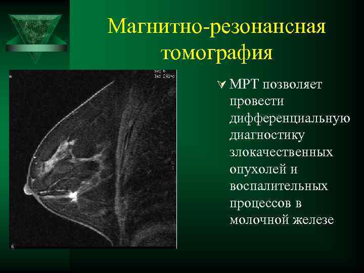 Магнитно резонансная томография Ú МРТ позволяет провести дифференциальную диагностику злокачественных опухолей и воспалительных процессов