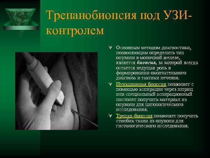 Трепанобиопсия под УЗИ контролем Ú Основным методом диагностики, позволяющим определить тип опухоли в молочной