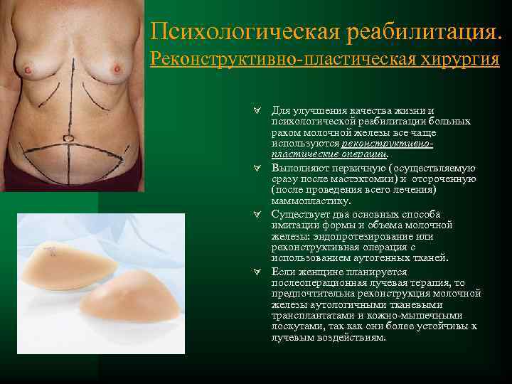 Психологическая реабилитация. Реконструктивно пластическая хирургия Ú Для улучшения качества жизни и психологической реабилитации больных