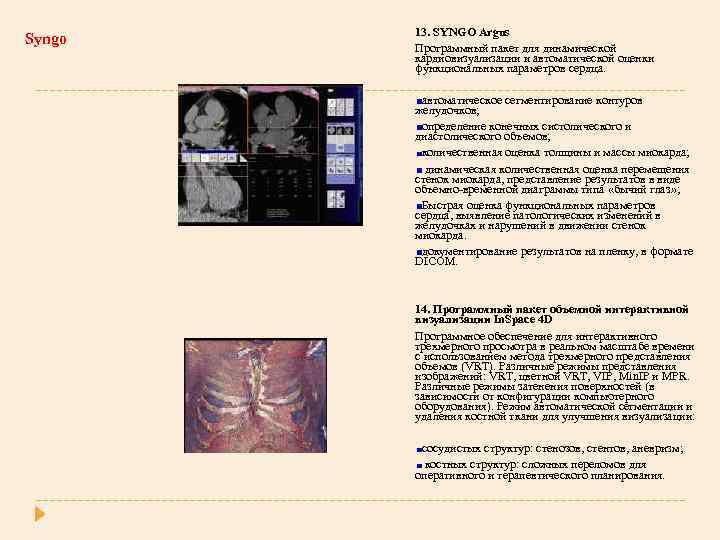 Syngo 13. SYNGO Argus Программный пакет для динамической кардиовизуализации и автоматической оценки функциональных параметров