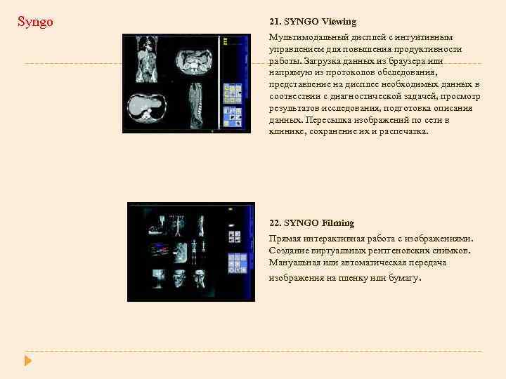 Syngo 21. SYNGO Viewing Мультимодальный дисплей с интуитивным управлением для повышения продуктивности работы. Загрузка