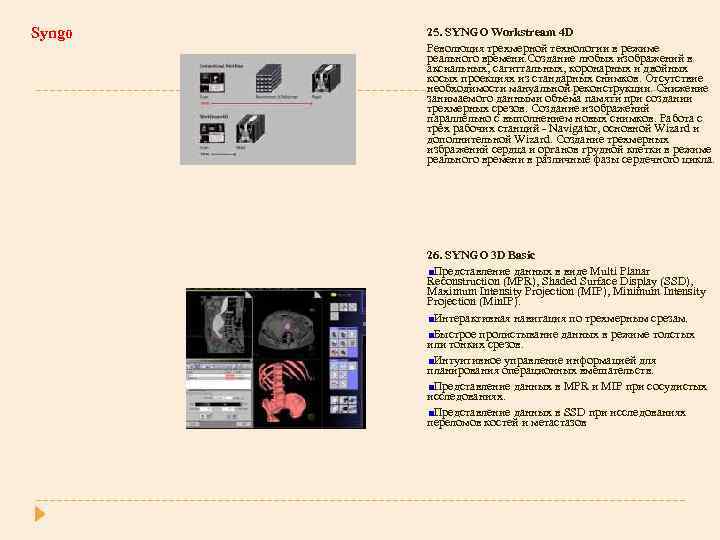 Syngo 25. SYNGO Workstream 4 D Революция трехмерной технологии в режиме реального времени. Создание