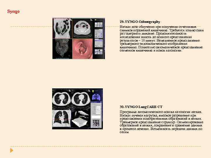 Syngo 29. SYNGO Colonography Низкая доза облучения при получении отчетливых снимков поражений кишечника. Требуется