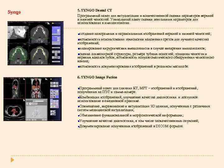 Syngo 5. SYNGO Dental CT Программный пакет для визуализации и количественной оценки параметров верхней