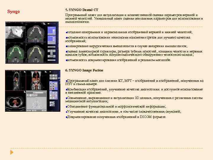 Syngo 5. SYNGO Dental CT Программный пакет для визуализации и количественной оценки параметров верхней