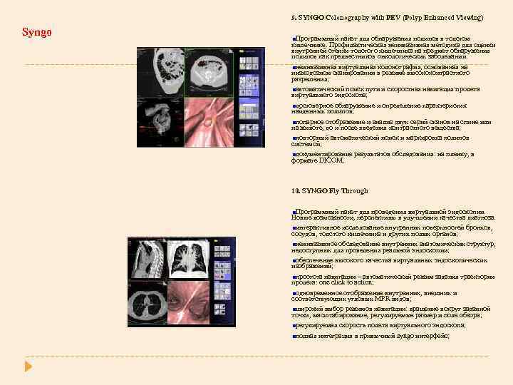 9. SYNGO Colonography with PEV (Polyp Enhanced Viewing) Syngo Программный пакет для обнаружения полипов