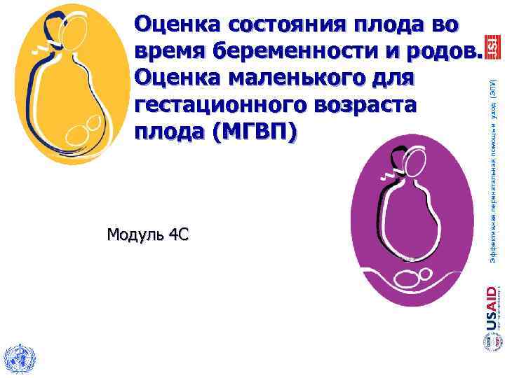 Модуль 4 С Эффективная перинатальная помощь и уход (ЭПУ) Оценка состояния плода во время