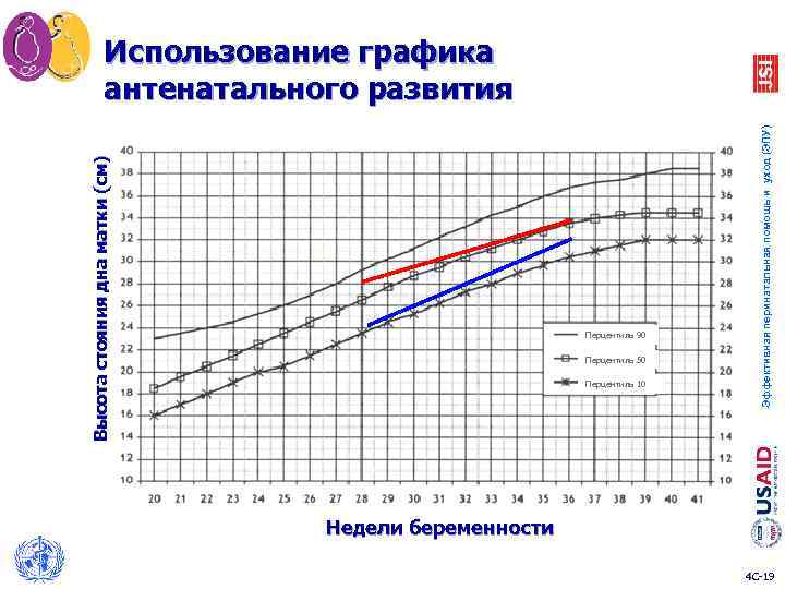 Перцентиль 90 Перцентиль 50 Перцентиль 10 Эффективная перинатальная помощь и уход (ЭПУ) Высота стояния