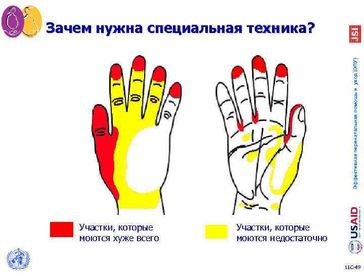 Эффективная перинатальная помощь и уход (ЭПУ) Зачем нужна специальная техника? Участки, которые моются хуже