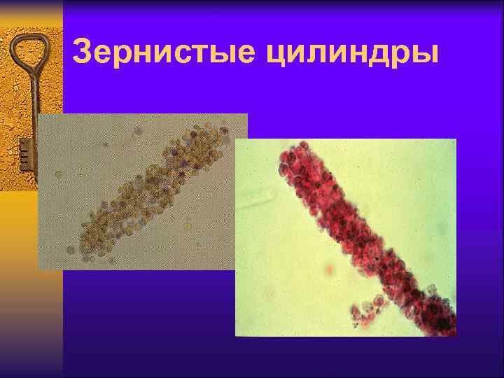 Зернистые цилиндры 