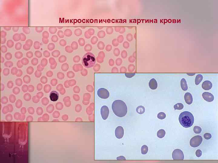 Микроскопическая картина крови 