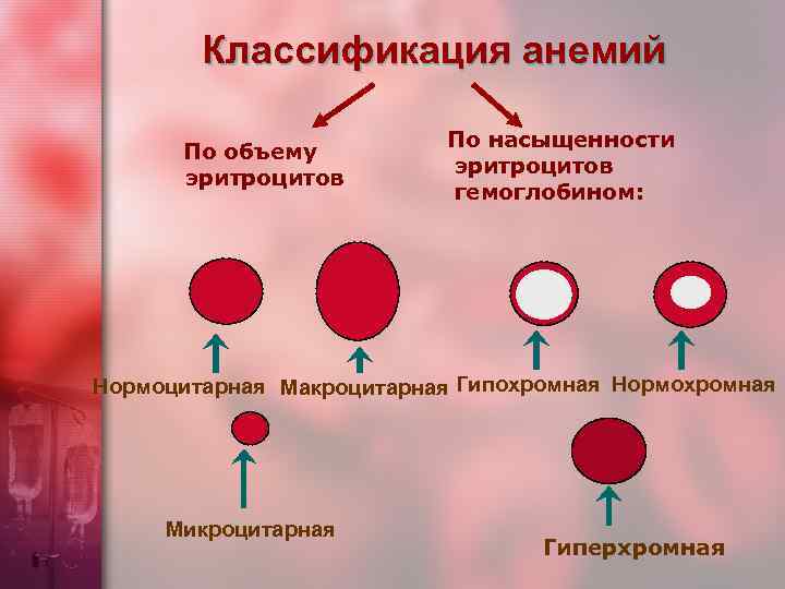 Классификация анемий По объему эритроцитов По насыщенности эритроцитов гемоглобином: Нормоцитарная Макроцитарная Гипохромная Нормохромная Микроцитарная